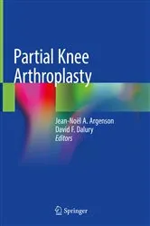 Book cover of Partial Knee Arthroplasty by Jean-Noël A. Argenson