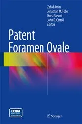 Book cover of Patent Foramen Ovale by Zahid Amin