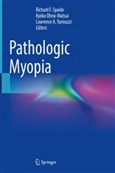 Book cover of Pathologic Myopia (2nd ed.) by Richard F. Spaide