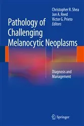 Book cover of Pathology of Challenging Melanocytic Neoplasms by Christopher R. Shea