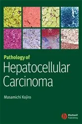 Book cover of Pathology of Hepatocellular Carcinoma by Masamichi Kojiro