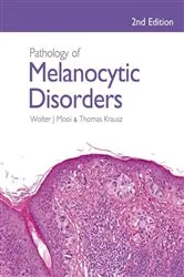 Book cover of Pathology of Melanocytic Disorders 2ed (2nd ed.) by Walter Mooi