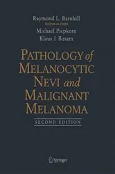 Book cover of Pathology of Melanocytic Nevi and Malignant Melanoma (2nd ed.) by Michael Piepkorn