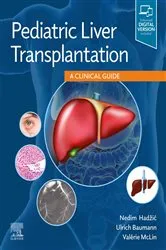 Book cover of Pediatric Liver Transplantation by Nedim Hadzic