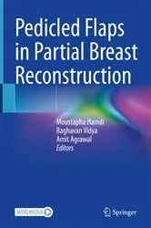 Book cover of Pedicled Flaps in Partial Breast Reconstruction by Moustapha Hamdi