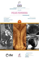 Book cover of Pelve Feminina - Volume 11 by Ronaldo Hueb Baroni