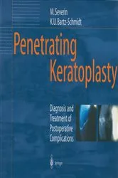Book cover of Penetrating Keratoplasty by Maria Severin
