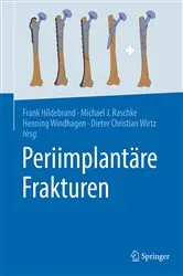 Book cover of Periimplantäre Frakturen by Frank Hildebrand