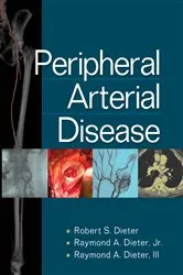 Book cover of Peripheral Arterial Disease by Robert S. Dieter