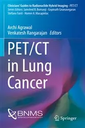 Book cover of PET/CT in Lung Cancer by Archi Agrawal