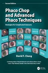 Book cover of Phaco Chop and Advanced Phaco Techniques (2nd ed.) by David F. Chang