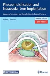Book cover of Phacoemulsification and Intraocular Lens Implantation (2nd ed.) by Unknown