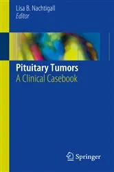 Book cover of Pituitary Tumors by Lisa B. Nachtigall