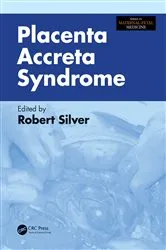Book cover of Placenta Accreta Syndrome by Robert Silver