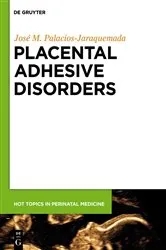 Book cover of Placental Adhesive Disorders by José Miguel Palacios-Jaraquemada