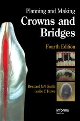 Book cover of Planning and Making Crowns and Bridges (4th ed.) by Bernard G. N. Smith