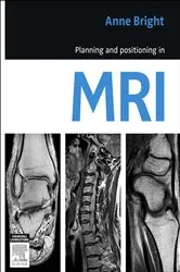Book cover of Planning and Positioning in MRI - E-Book by Anne Bright