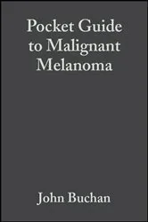 Book cover of Pocket Guide to Malignant Melanoma by John Buchan