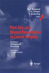 Book cover of Port-Site and Wound Recurrences in Cancer Surgery by M.A. Reymond
