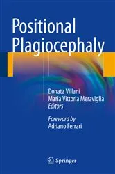 Book cover of Positional Plagiocephaly by Donata Villani