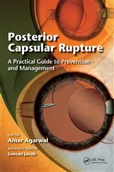 Book cover of Posterior Capsular Rupture by Amar Agarwal
