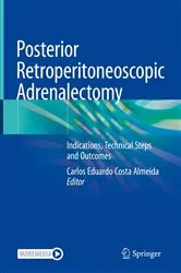 Book cover of Posterior Retroperitoneoscopic Adrenalectomy by Carlos Eduardo Costa Almeida