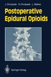 Book cover of Postoperative Epidural Opioids by Joachim Chrubasik