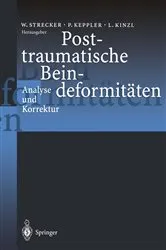 Book cover of Posttraumatische Beindeformitäten by Wolf Strecker