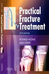 Book cover of Practical Fracture Treatment E-Book (5th ed.) by Unknown