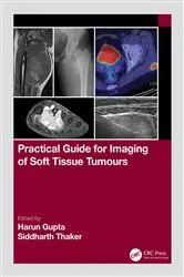 Book cover of Practical Guide for Imaging of Soft Tissue Tumours by Harun Gupta