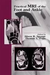 Book cover of Practical MRI of the Foot and Ankle by Alison R. Spouge