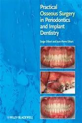 Book cover of Practical Osseous Surgery in Periodontics and Implant Dentistry by Serge Dibart