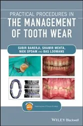 Book cover of Practical Procedures in the Management of Tooth Wear by Subir Banerji