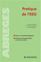 Book cover of Pratique de l'EEG by Jean Vion-Dury
