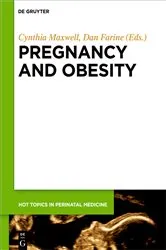 Book cover of Pregnancy and Obesity by Cynthia Maxwell