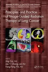 Book cover of Principles and Practice of Image-Guided Radiation Therapy of Lung Cancer by Jing Cai