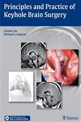 Book cover of Principles and Practice of Keyhole Brain Surgery by Charles Teo