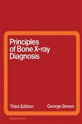 Book cover of Principles of Bone X-Ray Diagnosis (2nd ed.) by George Simon