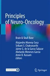 Book cover of Principles of Neuro-Oncology by Alejandro Monroy-Sosa