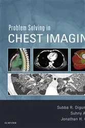Book cover of Problem Solving in Chest Imaging E-Book by Subba R. Digumarthy MD