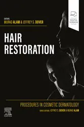 Book cover of Procedures in Cosmetic Dermatology: Hair Restoration - E-Book by Alam MD, MBA, MSCI, Murad