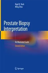 Book cover of Prostate Biopsy Interpretation (2nd ed.) by Rajal B. Shah
