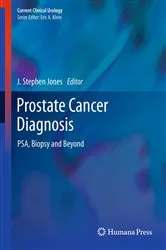Book cover of Prostate Cancer Diagnosis by J. Stephen Jones