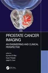 Book cover of Prostate Cancer Imaging by Ayman El-Baz