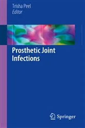 Book cover of Prosthetic Joint Infections by Trisha Peel