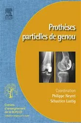 Book cover of Prothèses partielles du genou by Philippe Neyret