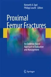 Book cover of Proximal Femur Fractures by Kenneth A. Egol