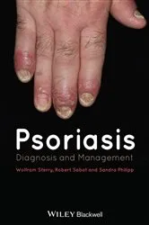 Book cover of Psoriasis by Wolfram Sterry