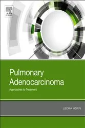 Book cover of Pulmonary Adenocarcinoma: Approaches to Treatment by Horn MD, MSc, MHPE, Leora