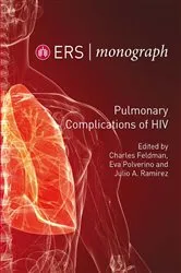 Book cover of Pulmonary Complications of HIV by Charles Feldman